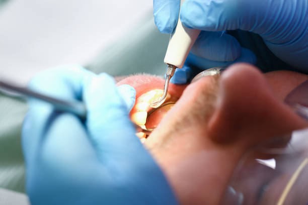 Best Urgent Care for Lost Fillings or Crowns in Valley Park, MO